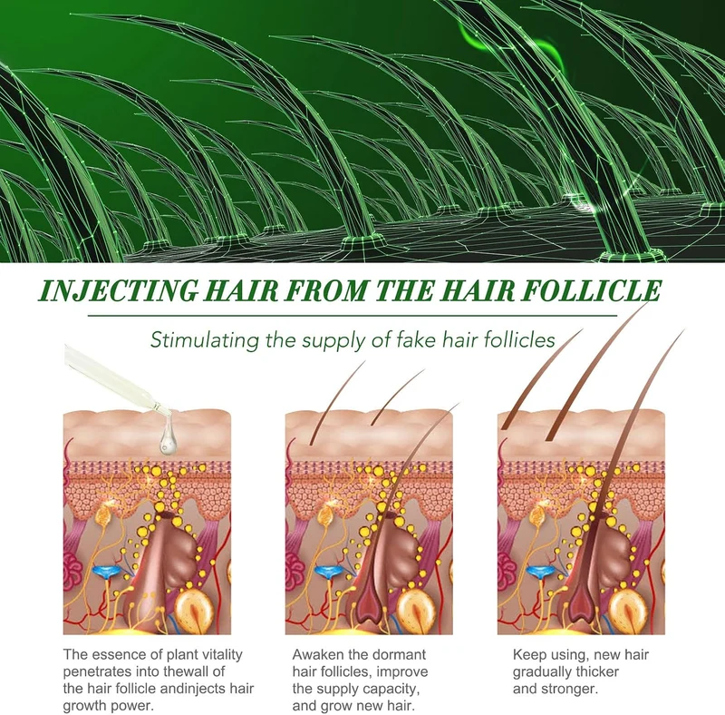 Rosmarinöl Haare, Ätherisches Rosmarinöl für Haarwuchs, Rosemary Oil for Hair, Natürliches Nährt die
