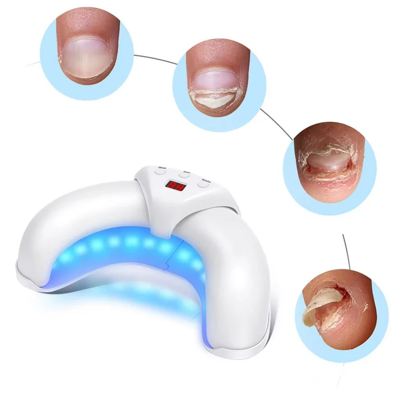 Nagelpilz-Lichtgerät ™ | Kraftvolle Lichttherapie gegen Nagelpilz