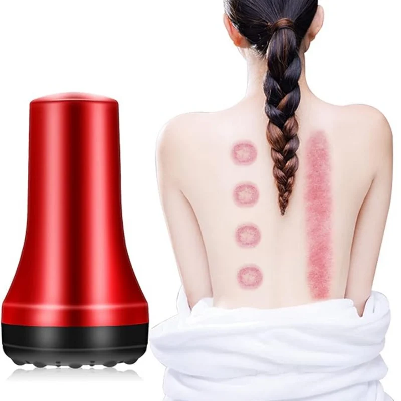 Elektrisches Vakuum-Schröpfkörpermassagegerät™ | Tiefenentspannung für Körper & Seele