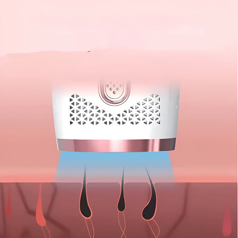 IPL-Laser dauerhaft™ | Dauerhafte, schmerzfreie Haarentfernung