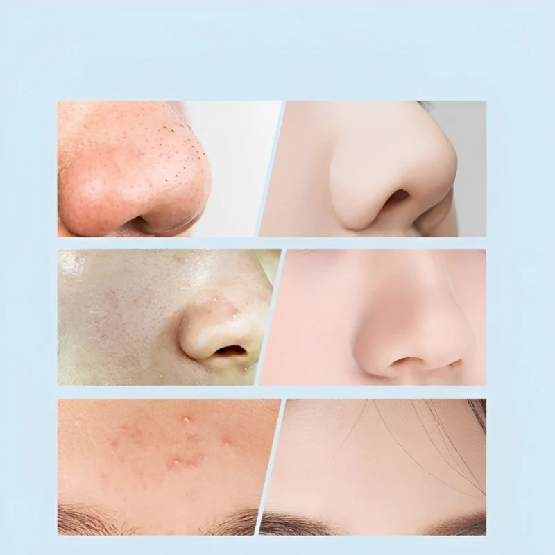 EpiderLook™ Klare Poren, klare Ansicht