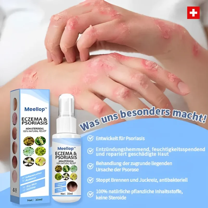 Meellop™ Kräuter-Psoriasis-Linderungsspray