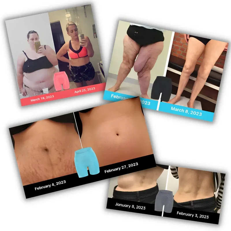 ShapingS™ | Shaping Shorts