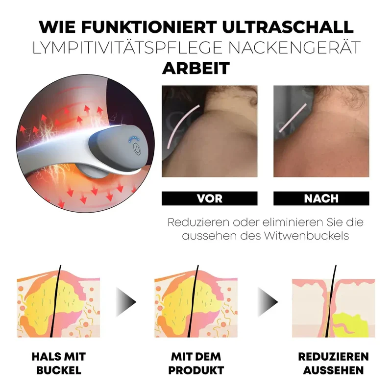 LymphoCure™ | Lymphatische Halsvorrichtung