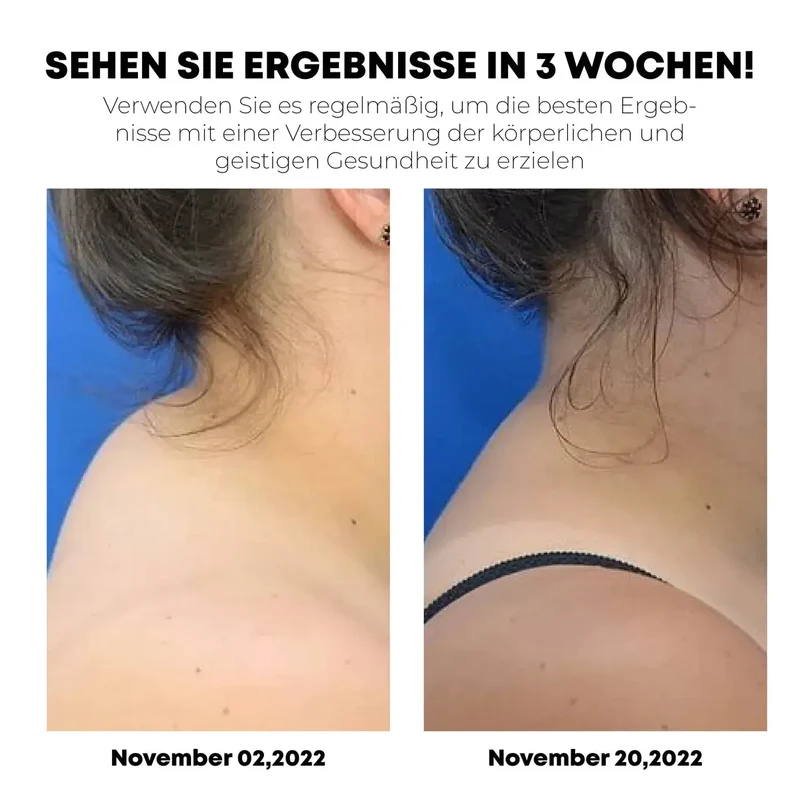 LymphoCure™ | Lymphatische Halsvorrichtung