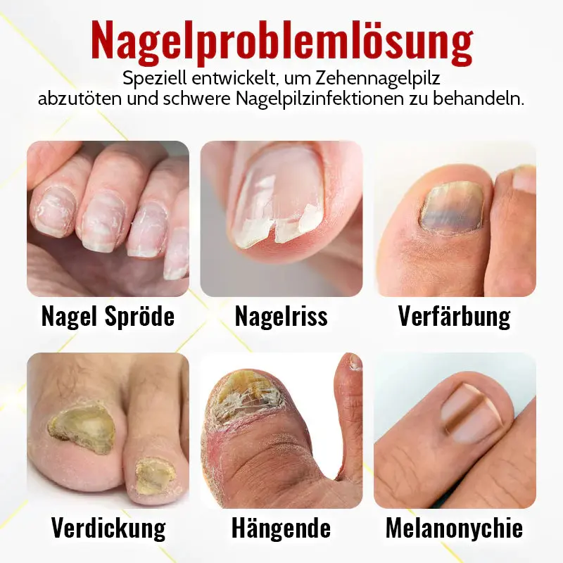 RevitalNail™ | Nagelwuchsöl