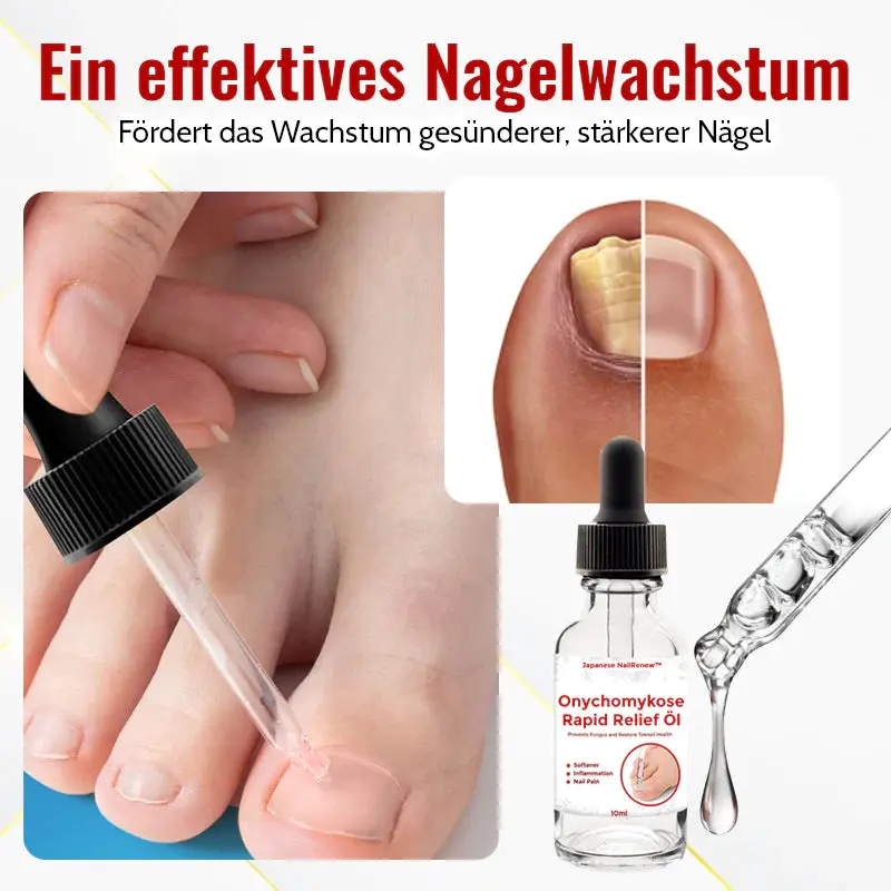 RevitalNail™ | Nagelwuchsöl