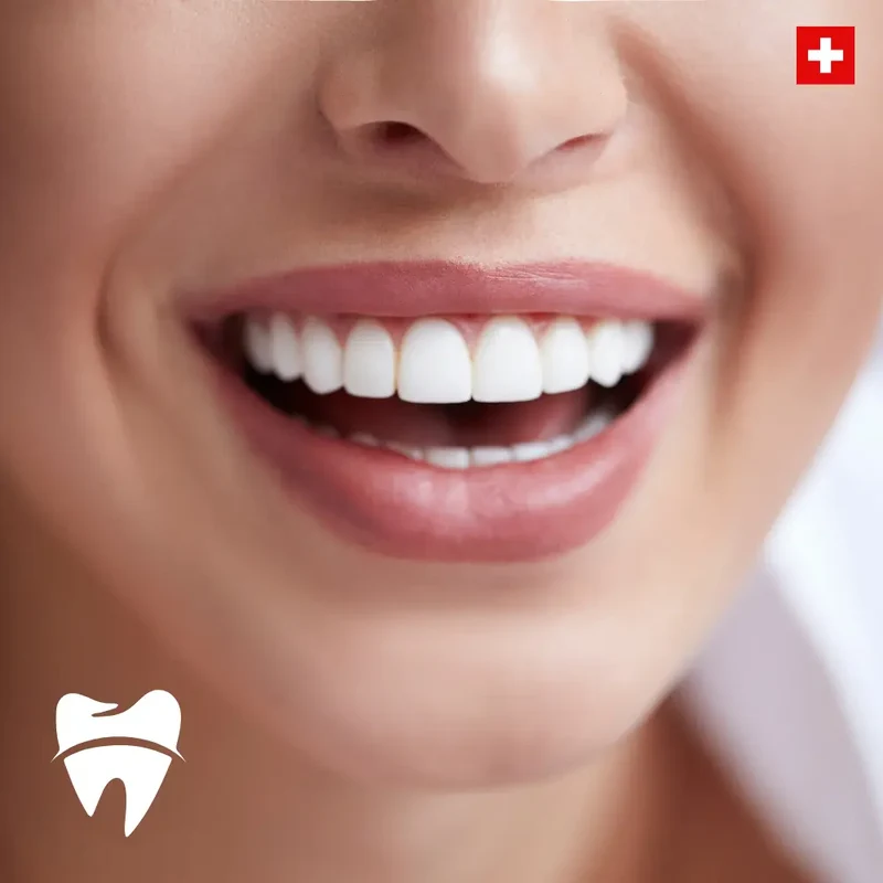 Theety™ | Einstellbarer Zahnersatz mit Schnappverschluss
